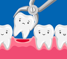 Illustration of a tooth extraction