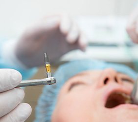 Closeup of dentist holding implant with instrument with patient blurry in background