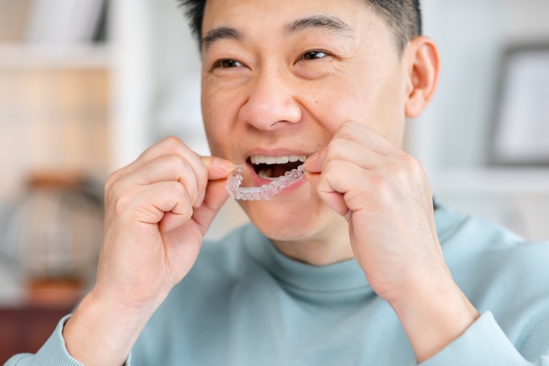 Man putting in clear aligners